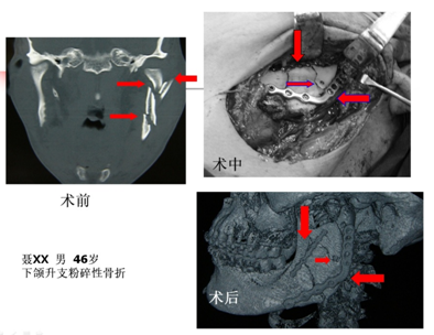 QQ图片20161109160356.png